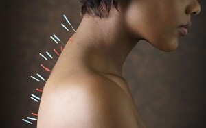 acupuncture_1248178c