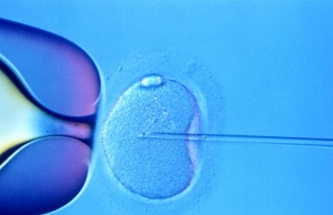 Assisted Reproduction